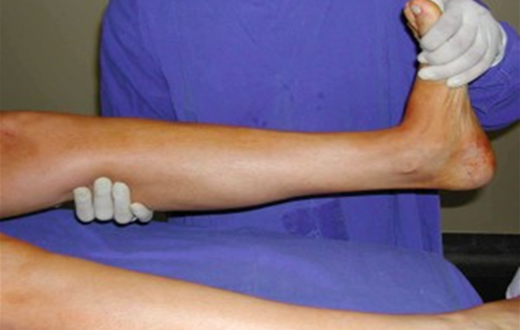 FMB promove palestras sobre coágulo sanguíneo