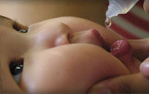 Botucatu inicia vacinação contra paralisia e sarampo