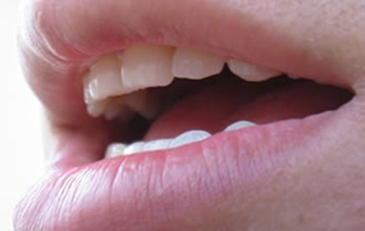 Mutirão visa prevenir e tratar doenças da voz