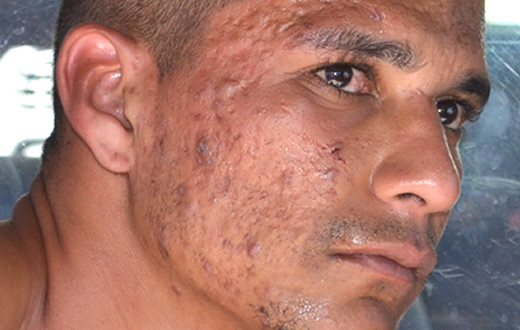 Acusado de estupro em Botucatu tem outro crime sexual