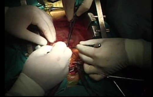 FMB é premiada em Encontro de Cirurgia Vascular