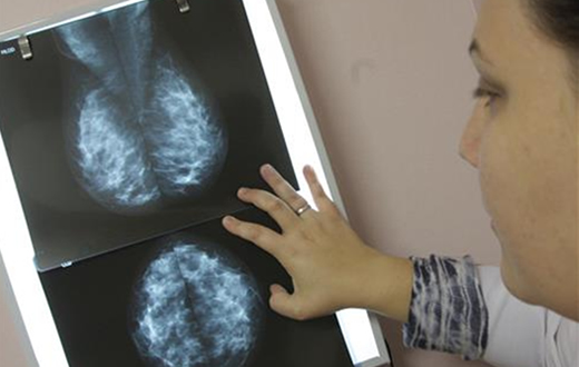 Centro da Mama já realizou 400 exames em Botucatu