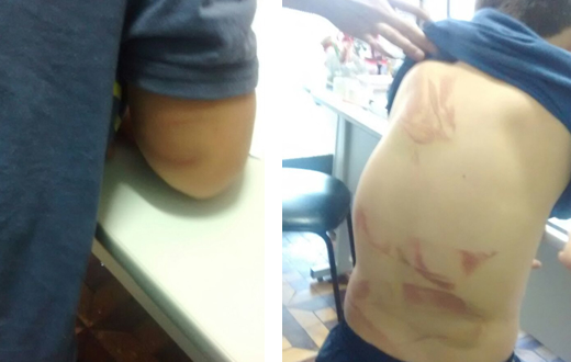 DDM atende caso de violência contra menino de 7 anos