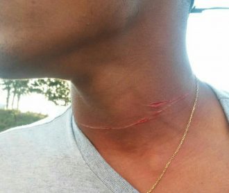 2016-07-15-PHOTO-00039754