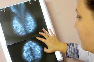 outubro-rosa-centro-de-doencas-da-mama-foto-igor-medeiros-10-foto-arquivo-custom