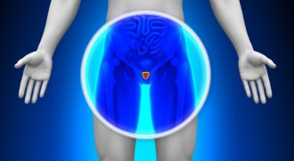 radioterapia-cancer-prostata