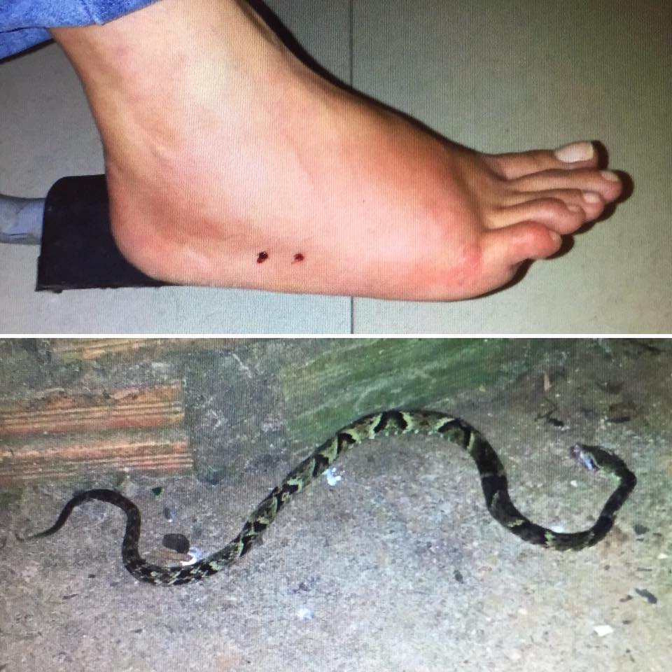 Acidentes com aranha e cobra levam duas pessoas para o hospital em Botucatu; casos aumentam no calor