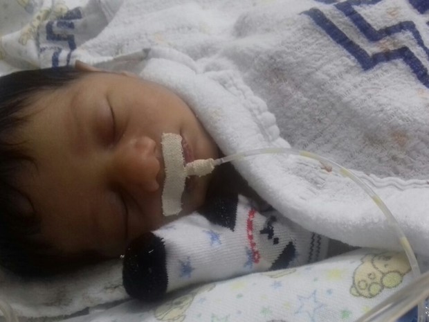 Bebê é operado em Botucatu após tentar vaga em hospital especializado