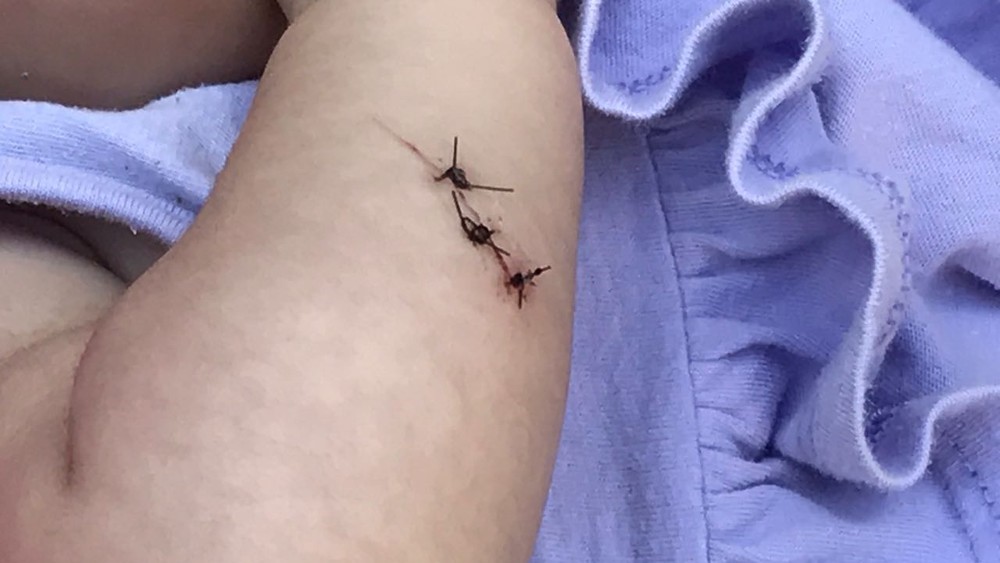 Assaltante esfaqueia bebê de três meses por causa de celular em Bauru