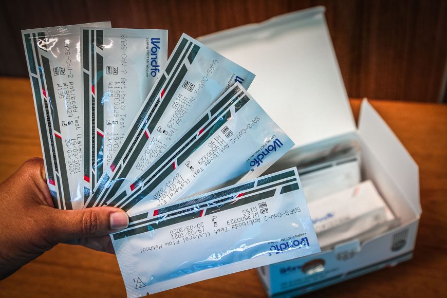 Anvisa discute liberar teste rápido para covid-19 em farmácias