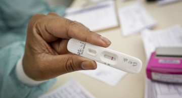 Anvisa aprova uso e comercialização de autoteste para covid-19
