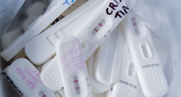 Procon-SP fiscaliza preços abusivos de testes de covid-19