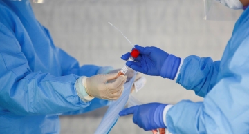 Botucatu registra mais um óbito por covid, diz Prefeitura