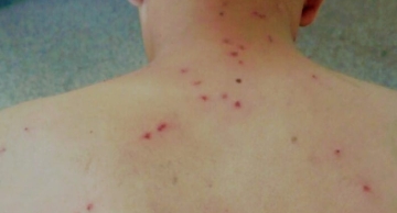 Família é atacada por abelhas africanizadas em área verde do Residencial Lívia 2 em Botucatu