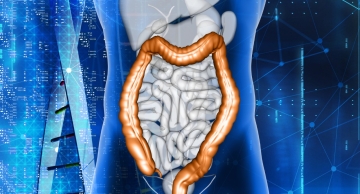 Doenças Inflamatórias Intestinais: o que são e como tratar?