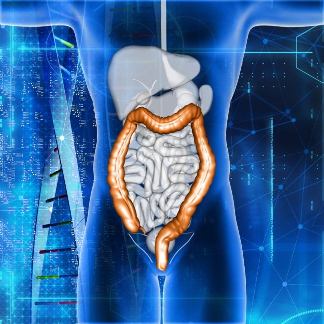 Doenças Inflamatórias Intestinais O Que São E Como Tratar Jornal Acontece Botucatu 