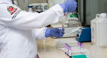 Novos exames são implantados em Laboratório do HC de Botucatu