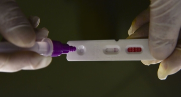 Pesquisadores do interior de SP identificam método capaz de prever gravidade da covid-19