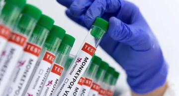 Anvisa aprova registro de 1º teste para varíola dos macacos
