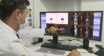 Câncer de próstata tem novo tratamento com radioterapia reduzida