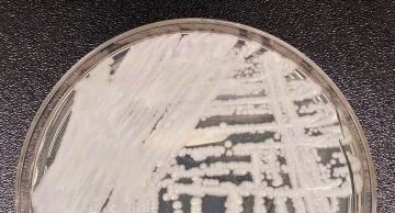 São Paulo confirma primeiro caso de superfungo Candida auris