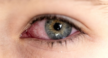 Cartilha sobre saúde ocular na infância orienta pais e professores Cartilha sobre saúde ocular na infância orienta pais e professores