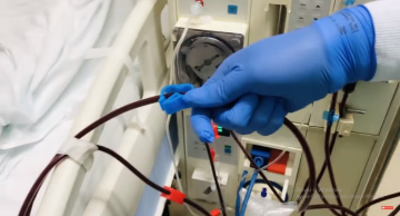 Setor de diálise do HCFMB fez mais de 21 mil atendimentos no primeiro semestre de 2023