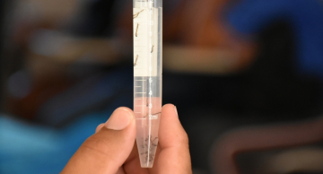 Botucatu intensifica ações para combater a dengue