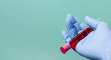 Exame de sangue pode ajudar a prever o risco de apneia obstrutiva do sono