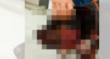 Onça-parda mata pit bull e fere rottweiler que protegiam sítio no interior de SP