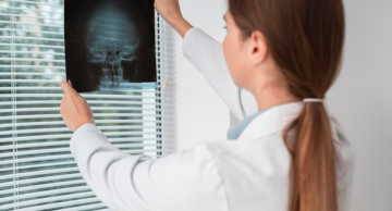 Exames de Raio-x estão sendo reagendados devido ao Ponto Facultativo em Botucatu