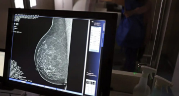 Tecnologia do micro-ondas propõe alternativa à mamografia tradicional, mostra estudo Tecnologia do micro-ondas propõe alternativa à mamografia tradicional, mostra estudo