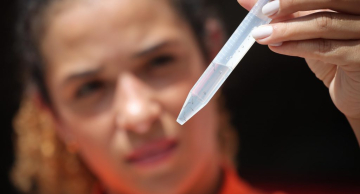 Doenças como dengue, chikungunya e febre amarela têm sintomas parecidos, mostra estudo do Butantan Doenças como dengue, chikungunya e febre amarela têm sintomas parecidos, mostra estudo do Butantan