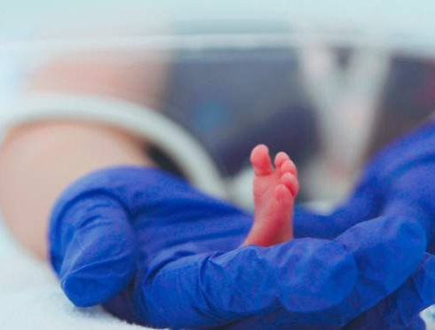 Estudo coordenado por pesquisadoras da Unesp reduz mortalidade em UTIs neonatais