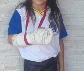 Criança se fere em garrafa quebrada em praça em frente a escola em Botucatu