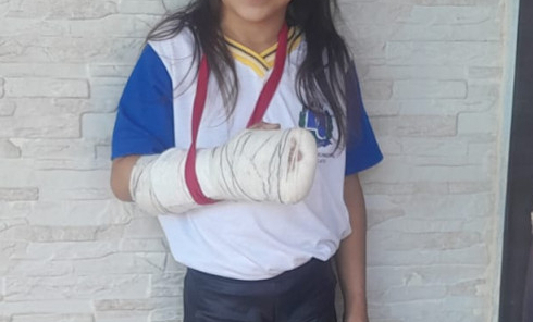 Criança se fere em garrafa quebrada em praça em frente a escola em Botucatu