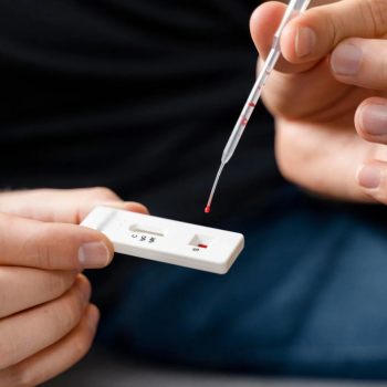 Botucatu capacita 30 profissionais para ampliar testes rápidos de HIV, sífilis e hepatites nos PAs noturnos