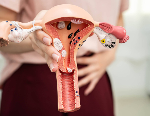 Estudo da Unesp de Botucatu alerta para fatores de risco da vaginose bacteriana